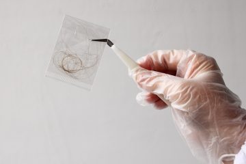 Hair Follicle Test
